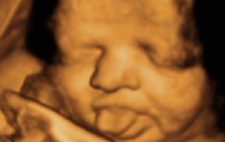 Services / Packages - Picture Perfect 3D/4D Ultrasound