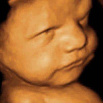 picture perfect imaging 3d ultrasound houston 4d ultrasound houston tx texas location clinic center near me