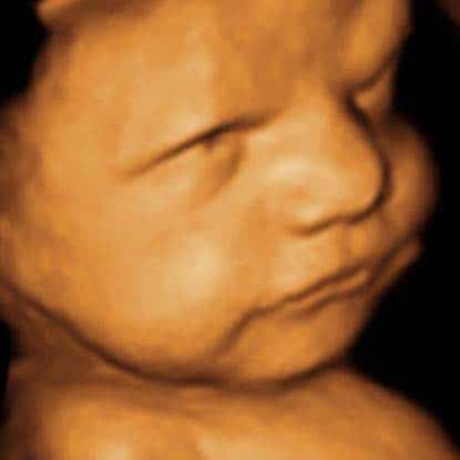 3d Ultrasound Houston And 4d Ultrasound Houston Picture Perfect Imaging 3d 4d Ultrasound