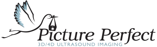 Picture Perfect 3D 4D