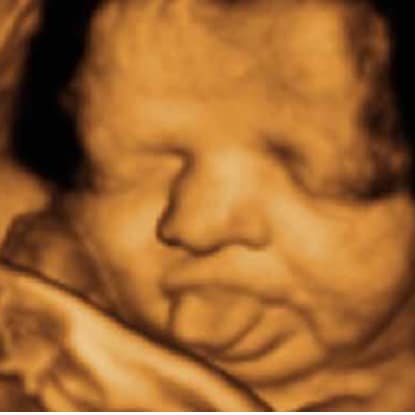 How much is a 3d 4d ultrasound cost